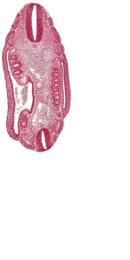 T-4 spinal ganglion primordium, aorta, dermatomyotome 16 (T-4), dermatomyotome 17 (T-5), dermatomyotome 18 (T-6), dermatomyotome 24 (T-12), mesonephric duct, mesonephric ridge, mesonephric vesicle(s), neural tube