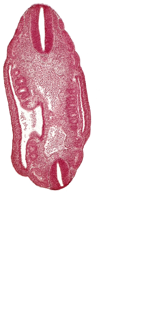 T-4 spinal ganglion primordium, aorta, dermatomyotome 16 (T-4), dermatomyotome 17 (T-5), dermatomyotome 18 (T-6), dermatomyotome 24 (T-12), mesonephric duct, mesonephric ridge, mesonephric vesicle(s), neural tube