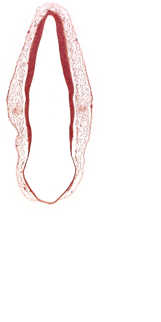 alar plate of rhombencephalon, cephalic edge of otic vesicle, ectodermal tag of otic vesicle, rhombencoel (fourth ventricle), roof plate of rhombencephalon