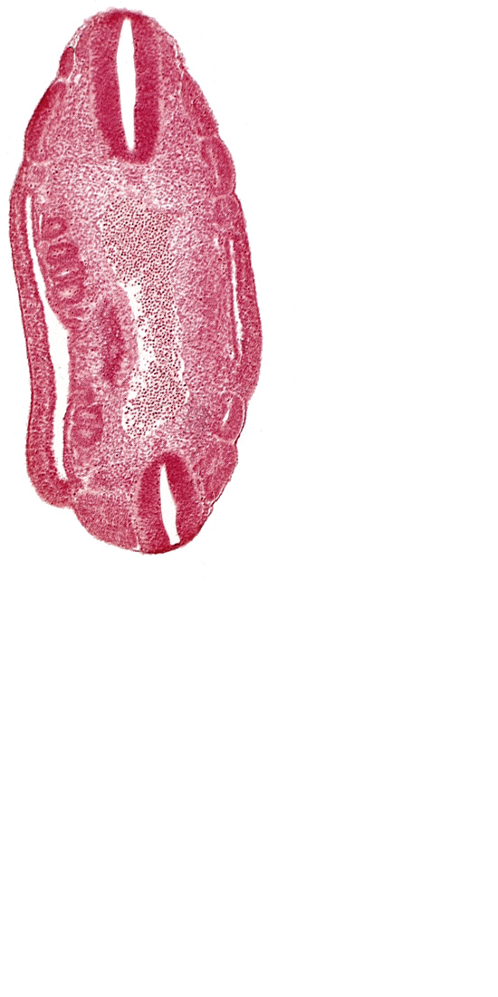 aorta, coelom, dermatomyotome 17 (T-5), dermatomyotome 18 (T-6), dermatomyotome 19 (T-7), dermatomyotome 23 (T-11), dermatomyotome 24 (T-12), edge of coelom, mesonephric vesicle(s)