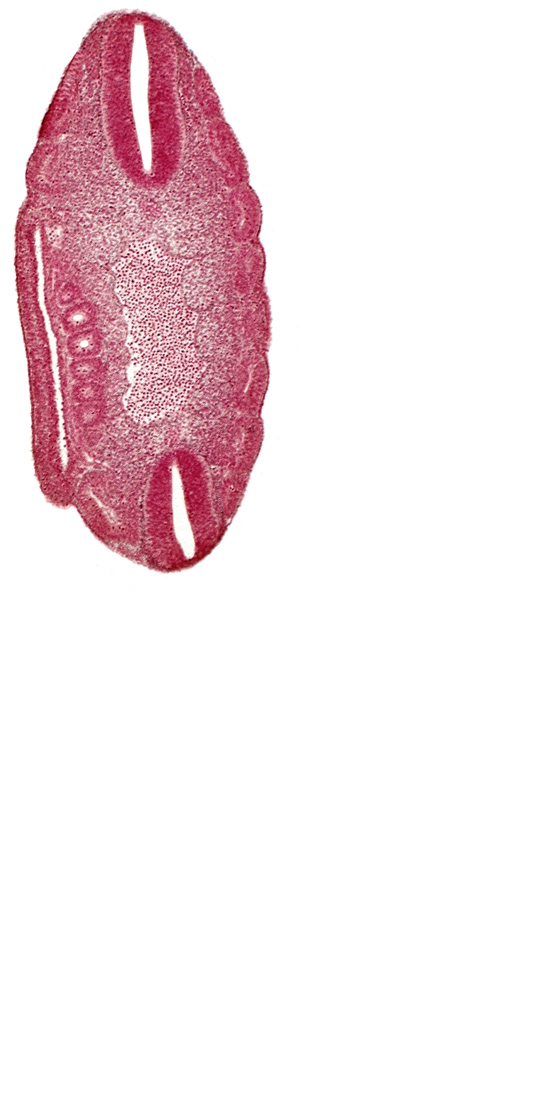 aorta, coelom, dermatomyotome 17 (T-5), dermatomyotome 18 (T-6), dermatomyotome 19 (T-7), dermatomyotome 20 (T-8), dermatomyotome 22 (T-10), dermatomyotome 23 (T-11), dermatomyotome 24 (T-12), mesonephric vesicle(s)