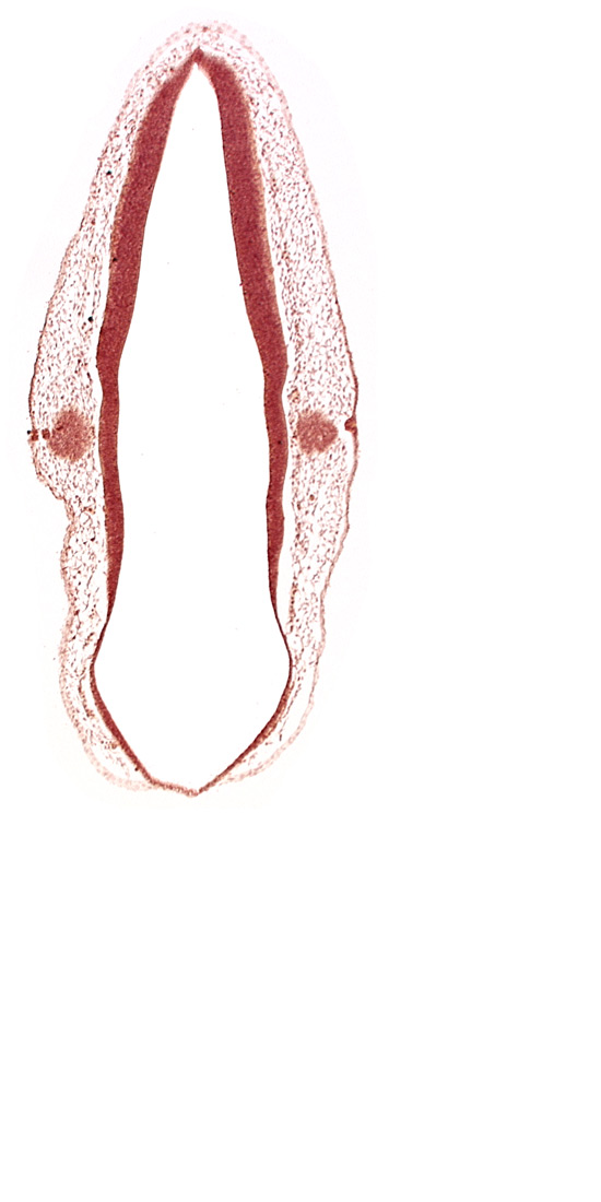 alar plate of rhombencephalon, cephalic edge of otic vesicle, ectodermal tag of otic vesicle, rhombencoel (fourth ventricle), roof plate of rhombencephalon