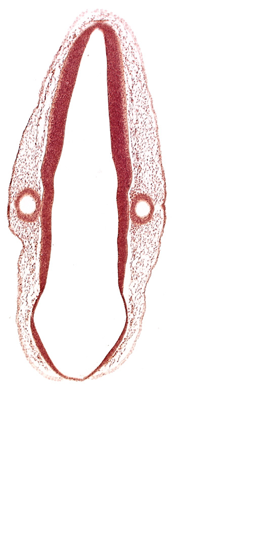 head mesenchyme, mantle layer, marginal layer, otic vesicle, otic vesicle cavity, rhombencoel (fourth ventricle), rhombomere 6, surface ectoderm, venous plexus(es)