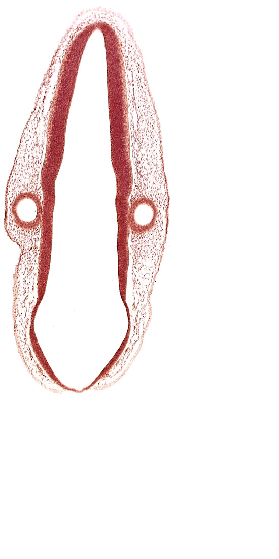 mantle layer, marginal layer, otic vesicle, otic vesicle cavity, posterior dural venous plexus, rhombencoel (fourth ventricle), rhombomere 6, surface ectoderm