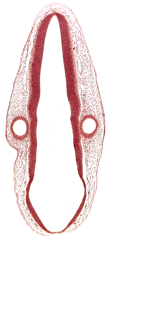 mantle layer, marginal layer, otic vesicle, otic vesicle cavity, posterior dural venous plexus, rhombencoel (fourth ventricle), rhombomere 6, roof plate, surface ectoderm