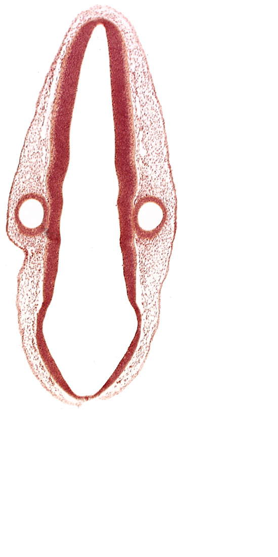 head mesenchyme, mantle layer, marginal layer, otic vesicle, otic vesicle cavity, posterior dural venous plexus, rhombencoel (fourth ventricle), rhombomere 6, roof plate, surface ectoderm