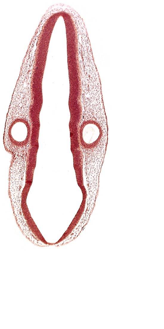 head mesenchyme, mantle layer, marginal layer, otic vesicle, posterior dural venous plexus, rhombencoel (fourth ventricle), surface ectoderm