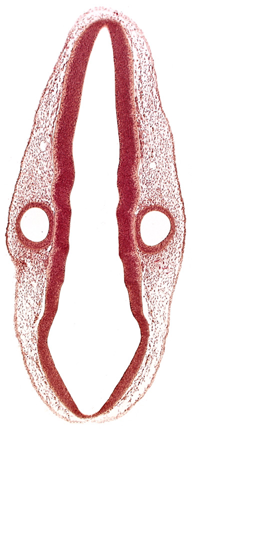 cranial edge of root of accessory nerve (CN XI), cranial edge of root of vagus nerve (CN X), mantle layer, marginal layer, middle dural venous plexus, otic vesicle, posterior dural venous plexus, rhombencephalon (hindbrain), rhombencoel (fourth ventricle), rhombomere 4, rhombomere 6, rhombomere 7, roof plate