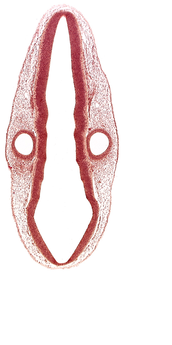 mantle layer, marginal layer, middle dural venous plexus, otic vesicle, rhombencephalon (hindbrain), rhombencoel (fourth ventricle), rhombomere 4, rhombomere 6, rhombomere 7, roof plate