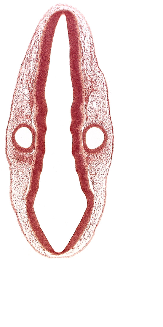 cephalic edge of dermatomyotome 1 (O-1), head mesenchyme, otic vesicle, rhombomere 6, root of accessory nerve (CN XI), root of glossopharyngeal nerve (CN IX), root of vagus nerve (CN X), rostral edge of root of facial nerve (CN VII), rostral edge of root of vestibulocochlear nerve (CN VIII), surface ectoderm