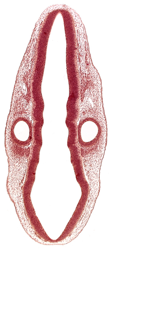 cephalic edge of dermatomyotome 1 (O-1), head mesenchyme, otic vesicle, posterior dural venous plexus, primordium of vagus and accessory nerves (CN X and CN XI), rhombomere 6, root of facial nerve (CN VII), root of glossopharyngeal nerve (CN IX), root of vestibulocochlear nerve (CN VIII), surface ectoderm