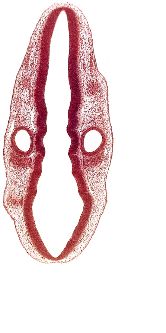 dermatomyotome 1 (O-1), primordium of facial and vestibulocochlear nerves (CN VII and CN VIII), primordium of glossopharyngeal nerve (CN IX), primordium of vagus nerve (CN X), rhombencoel (fourth ventricle), rhombomere 5, rhombomere 6, rhombomere 7