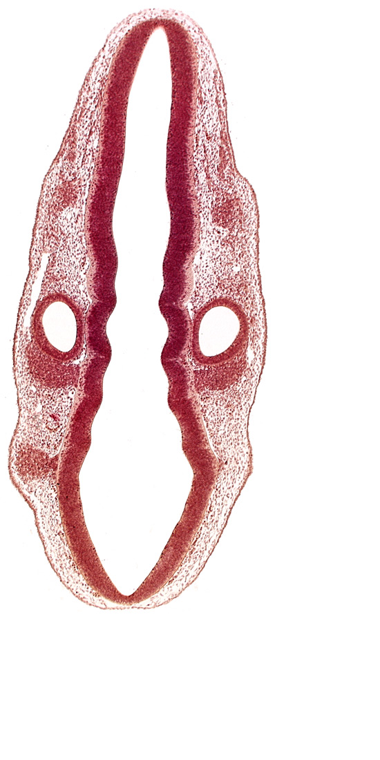 dermatomyotome 1 (O-1), primordium of facial and vestibulocochlear nerves (CN VII and CN VIII), primordium of glossopharyngeal nerve (CN IX), primordium of vagus nerve (CN X), rhombencoel (fourth ventricle), rhombomere 4, rhombomere 5, rhombomere 6, rhombomere 7