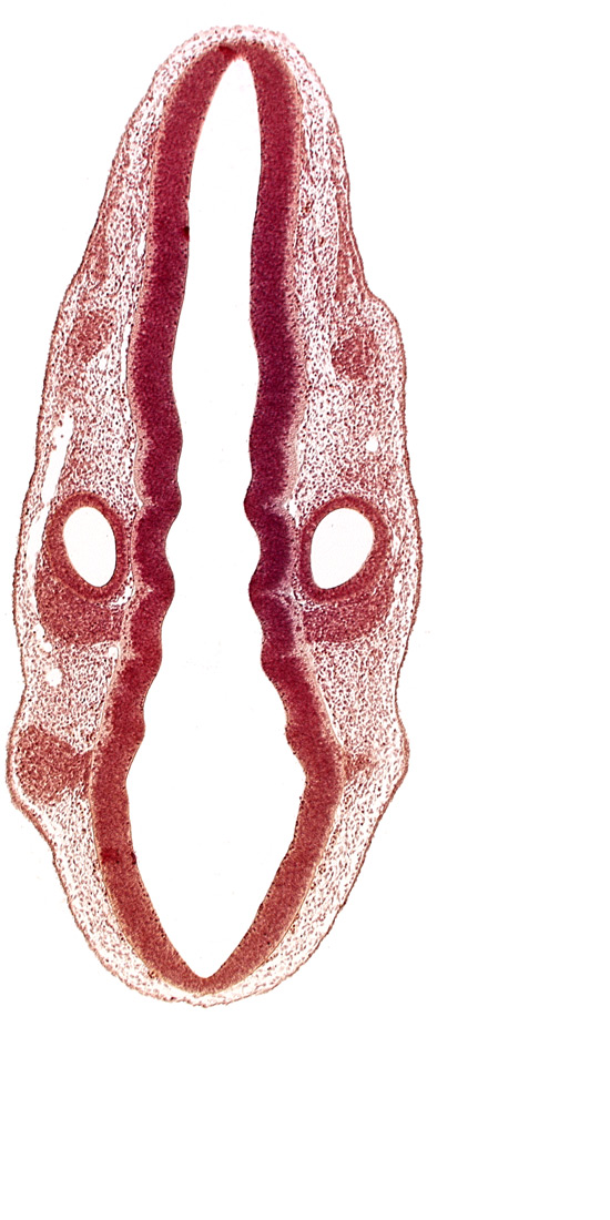 dermatomyotome 1 (O-1), middle dural venous plexus, primordium of facial and vestibulocochlear nerves (CN VII and CN VIII), primordium of glossopharyngeal nerve (CN IX), rhombencoel (fourth ventricle), rhombomere 5, rhombomere 6, rhombomere 7, root of trigeminal nerve (CN V)