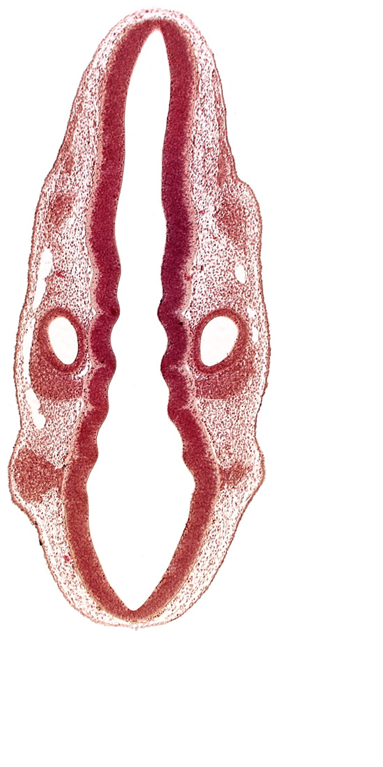 dermatomyotome 1 (O-1), posterior dural venous plexus, primordium of facial and vestibulocochlear nerves (CN VII and CN VIII), primordium of vagus nerve (CN X), rhombencoel (fourth ventricle), rhombomere 4, rhombomere 5, rhombomere 6, rhombomere 7, root of trigeminal nerve (CN V)