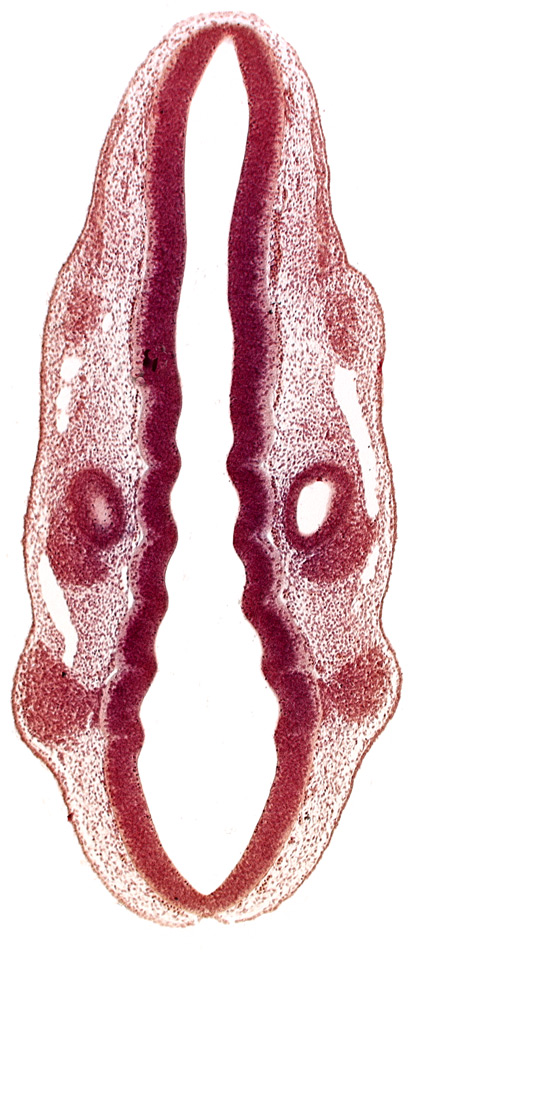 dermatomyotome 1 (O-1), dermatomyotome 2 (O-2) , marginal layer, otic vesicle, primary head vein, primordium of facial and vestibulocochlear nerves (CN VII and CN VIII), primordium of trigeminal nerve (CN V), primordium of vagus nerve (CN X), rhombencoel (fourth ventricle), rhombomere 2, rhombomere 4, rhombomere 7