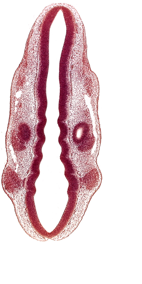 dermatomyotome 1 (O-1), dermatomyotome 2 (O-2) , marginal layer, primary head vein, primordium of facial and vestibulocochlear nerves (CN VII and CN VIII), primordium of trigeminal nerve (CN V), primordium of vagus nerve (CN X), rhombencoel (fourth ventricle), rhombomere 2, rhombomere 3, rhombomere 4, rhombomere 5, rhombomere 6, rhombomere 7