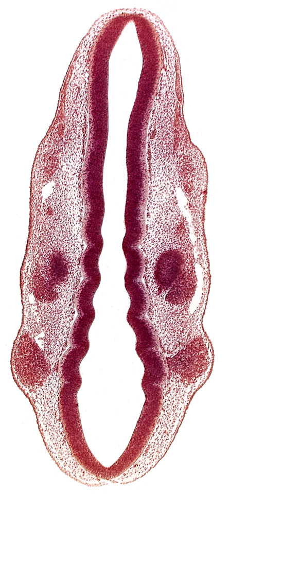 caudal edge of otic vesicle, dermatomyotome 1 (O-1), dermatomyotome 2 (O-2) , primary head vein, primordium of facial and vestibulocochlear nerves (CN VII and CN VIII), primordium of trigeminal nerve (CN V), primordium of vagus nerve (CN X), rhombencoel (fourth ventricle), rhombomere 2, rhombomere 3, rhombomere 4, rhombomere 6, rhombomere 7