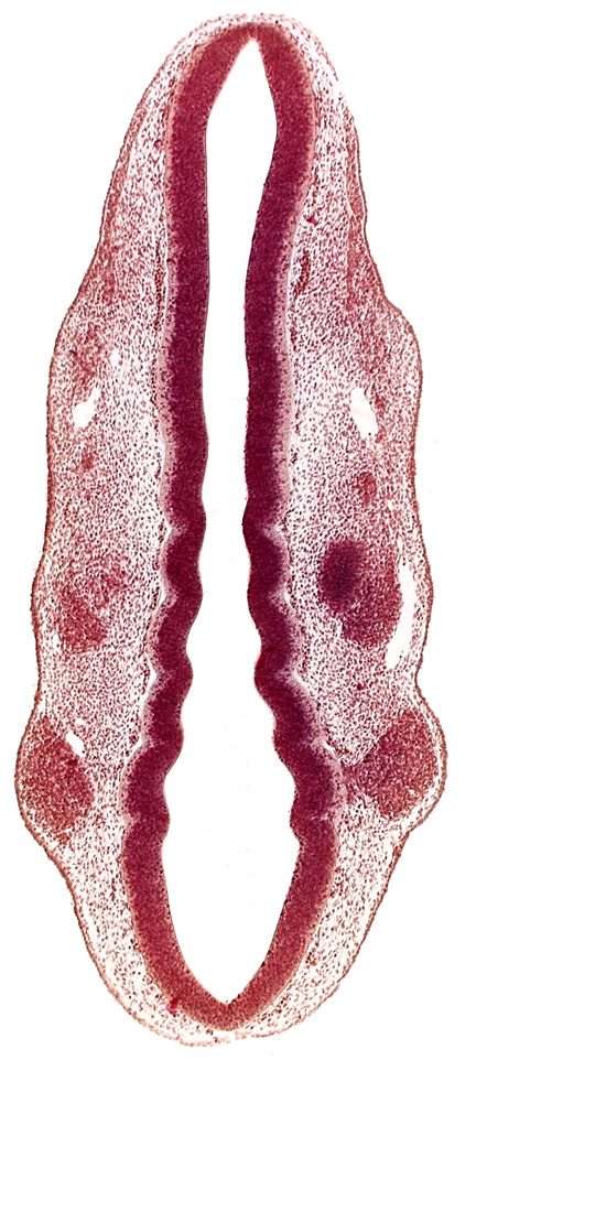 caudal edge of otic vesicle, dermatomyotome 1 (O-1), dermatomyotome 2 (O-2) , pharyngeal arch 1, pharyngeal groove 1, primary head vein, primordium of facial and vestibulocochlear nerves (CN VII and CN VIII), primordium of glossopharyngeal nerve (CN IX), primordium of trigeminal nerve (CN V), rhombencoel (fourth ventricle), rhombomere 2, rhombomere 3, rhombomere 4, rhombomere 5, rhombomere 7