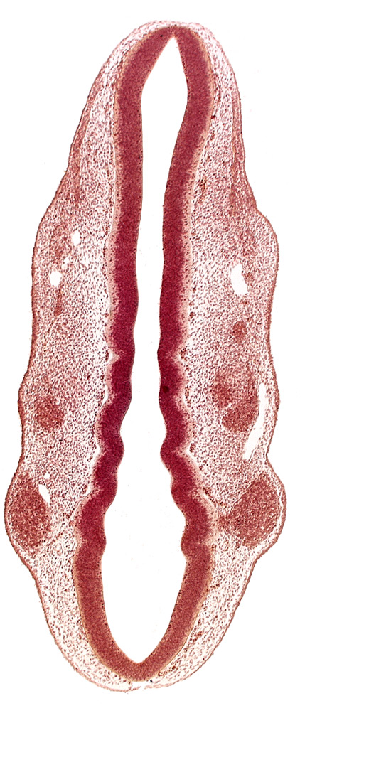 dermatomyotome 1 (O-1), dermatomyotome 2 (O-2) , pharyngeal arch 1, pharyngeal groove 1, primary head vein, primordium of facial and vestibulocochlear nerves (CN VII and CN VIII), primordium of trigeminal nerve (CN V), rhombomere 2, rhombomere 3, rhombomere 4, rhombomere 5, rhombomere 6