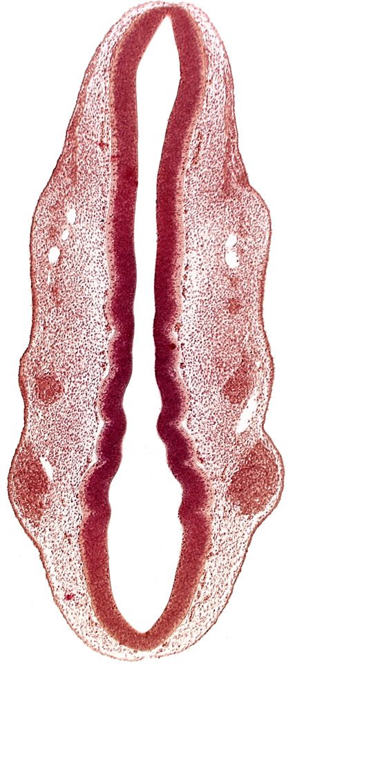 dermatomyotome 1 (O-1), dermatomyotome 2 (O-2) , pharyngeal arch 1, pharyngeal groove 1, primary head vein, primordium of facial nerve (CN VII), primordium of glossopharyngeal nerve (CN IX), primordium of trigeminal nerve (CN V), rhombomere 1, rhombomere 2, rhombomere 3, rhombomere 4, rhombomere 5, rhombomere 6