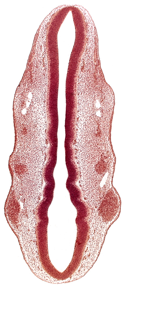 dermatomyotome 2 (O-2) , primary head vein, primordium of facial nerve (CN VII), primordium of glossopharyngeal nerve (CN IX), primordium of trigeminal nerve (CN V), rhombomere 2, rhombomere 3, rhombomere 4, rhombomere 5, rhombomere 6