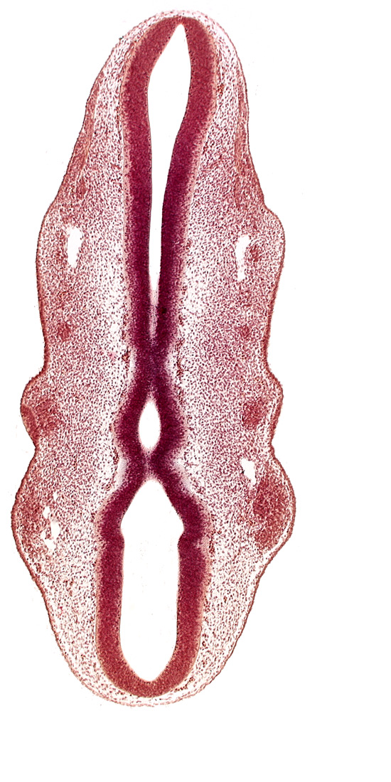 caudal edge of rhombencoel (fourth ventricle), caudal part of rhombencephalon, cephalic part of rhombencephalon, dermatomyotome 2 (O-2) , epipharyngeal placode 2, floor plate of rhombencephalon, junction of precardinal and primary head veins, marginal layer, primary head vein, primordium of facial nerve (CN VII), primordium of trigeminal nerve (CN V), primordium of vagus nerve (CN X), rhombencoel (fourth ventricle), rhombomere 1, rhombomere 2, roof plate of rhombencephalon, sulcus limitans, venous plexus(es), ventral part of rhombomere 4