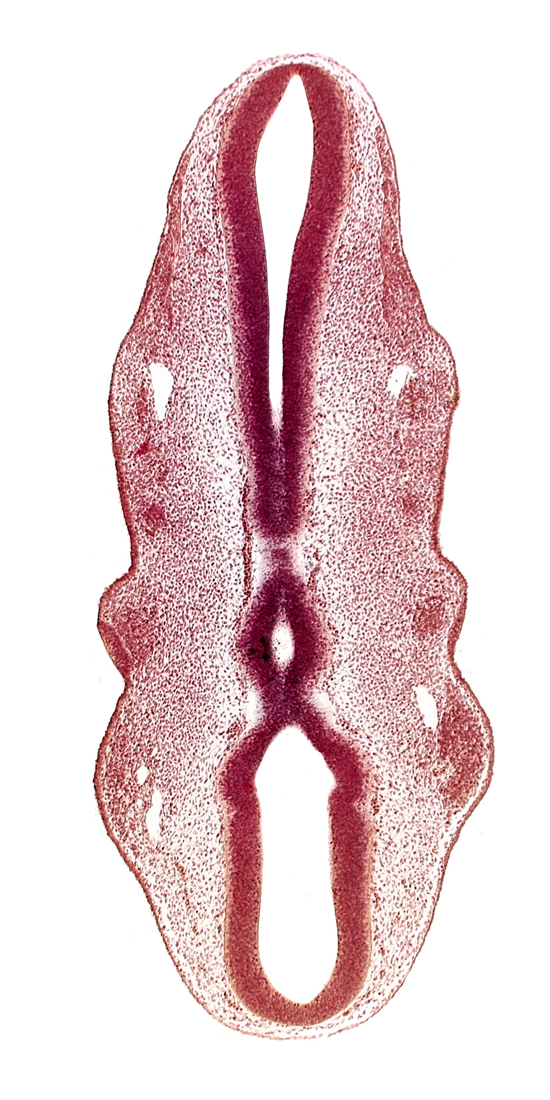 epipharyngeal placode 2, primary head vein, primordium of facial nerve (CN VII), rhombencoel (fourth ventricle), rhombomere 1, rhombomere 2, sulcus limitans, venous plexus(es)