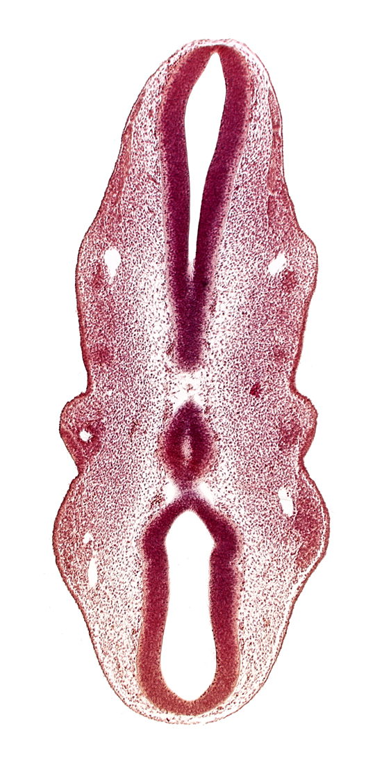 caudal part of rhombencephalon, epipharyngeal placode 2, precardinal vein, primary head vein, rhombencoel (fourth ventricle), rhombomere 1, rhombomere 2