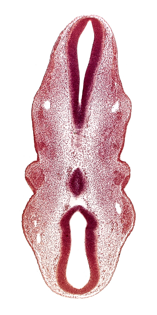 caudal part of rhombencephalon, cephalic part of rhombencephalon, precardinal vein, primary head vein, rhombencoel (fourth ventricle)