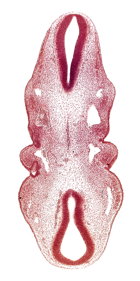 dermatomyotome 2 (O-2) , dermatomyotome 3 (O-3) , dorsal aorta, epipharyngeal placode 2, epipharyngeal placode 3, junction of aortic arch 2 and dorsal aorta, notochord, pharyngeal arch 1, pharyngeal arch 2, pharyngeal groove 1, pharyngeal groove 2, pharyngeal pouch 1, pharyngeal pouch 2, precardinal vein, sclerotome