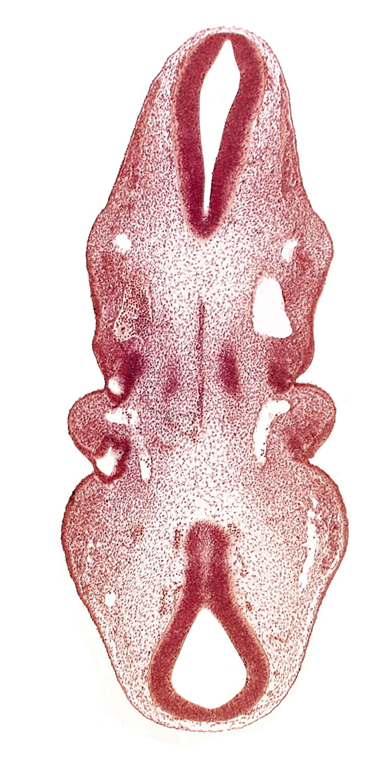 notochord, roof of pharynx primordium