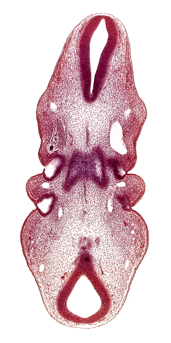 internal carotid artery, junction of mesencephalon and rhombencephalon, notochord, primordium of hypoglossal nerve (CN XII), roof of pharynx primordium