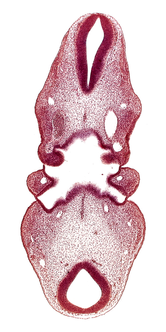 aortic arch 2, aortic arch 3, dermatomyotome 3 (O-3) , dorsal aorta (aortic arch 4), epipharyngeal placode 2, epipharyngeal placode 3, epipharyngeal placode 4, internal carotid artery, mesencoel (cerebral aqueduct), notochord, pharyngeal arch 2, pharyngeal pouch 2, pharynx primordium, precardinal vein, primordium of hypoglossal nerve (CN XII), region of mesencephalic (cephalic) flexure, sulcus limitans, tectum of mesencephalon, tegmentum of mesencephalon