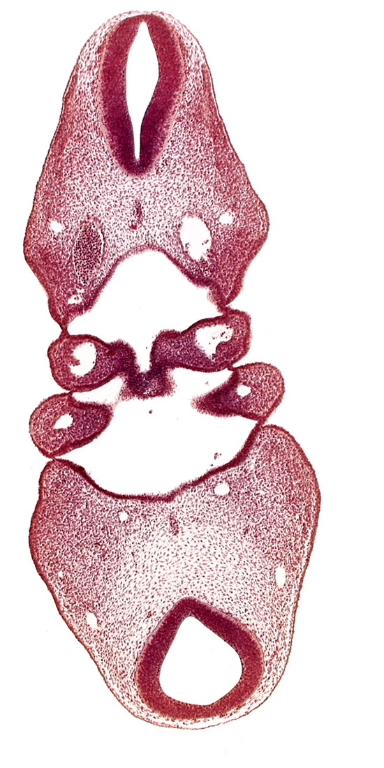 dermatomyotome 4 (O-4) , hypopharyngeal eminence of tongue, notochord, region of cervical flexure, region of mesencephalic (cephalic) flexure