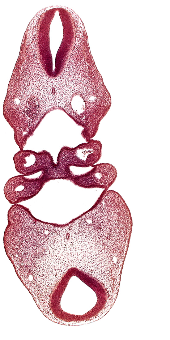 aortic arch 2, copula of tongue, dorsal aorta, notochord, pharyngeal arch 2, precardinal vein, region of mesencephalic (cephalic) flexure