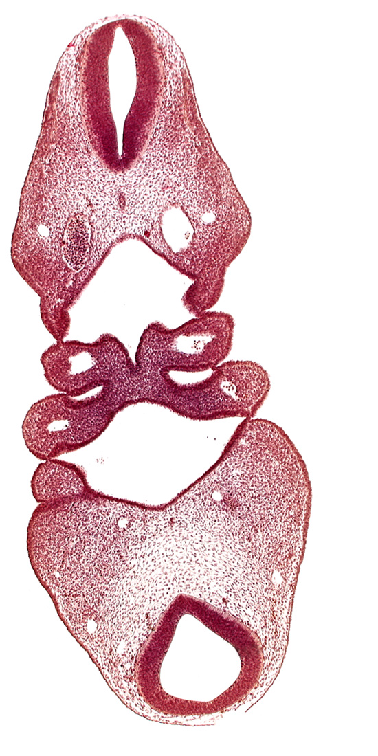 aortic arch 2, copula of tongue, dermatomyotome 4 (O-4) , dorsal aorta, mandibular prominence of pharyngeal arch 1, notochord, pharyngeal arch 2, pharyngeal pouch 1, precardinal vein, region of cervical flexure, region of mesencephalic (cephalic) flexure