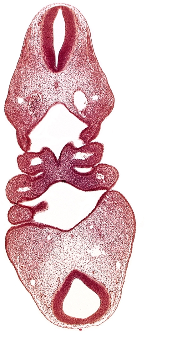 aortic arch 2, dermatomyotome 4 (O-4) , dorsal aorta, junction of rhombencephalon and spinal cord, mandibular prominence of pharyngeal arch 1, notochord, pharyngeal arch 2, pharyngeal pouch 1, precardinal vein, region of mesencephalic (cephalic) flexure