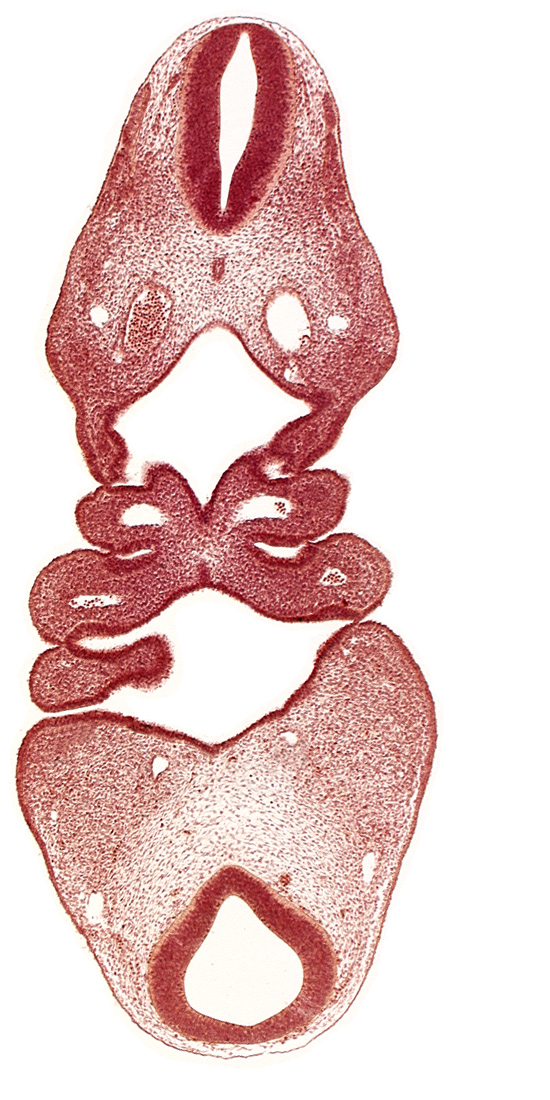 aortic arch 2, dermatomyotome 4 (O-4) , dermatomyotome 5 (C-1), dorsal aorta, junction of rhombencephalon and spinal cord, mandibular prominence of pharyngeal arch 1, notochord, pharyngeal arch 2, pharyngeal pouch 1, precardinal vein, thyroid diverticulum