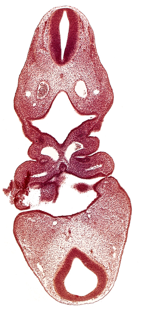 C-1 spinal ganglion primordium, adenohypophysial pouch, anterior dural venous plexus, cervical sinus, dermatomyotome 5 (C-1), epicardial ridge, epipharyngeal placode 4, internal carotid artery, mesencephalon, notochord, pharyngeal arch 3, pharyngeal arch 4, pharyngeal pouch 1, pharyngeal pouch 2, pharynx primordium, precardinal vein