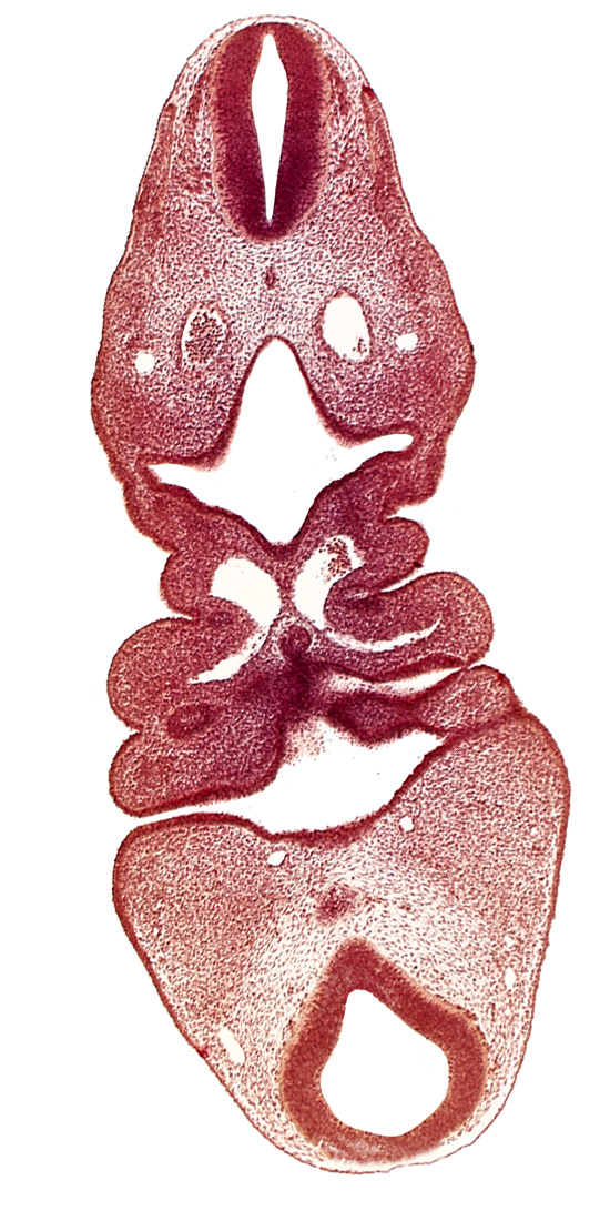 C-1 spinal ganglion primordium, adenohypophysial pouch, cervical sinus, dermatomyotome 5 (C-1), edge of mamillary recess, epicardial ridge, epipharyngeal placode 4, internal carotid artery, mesencephalon, pharyngeal arch 3, pharyngeal arch 4, pharyngeal pouch 1