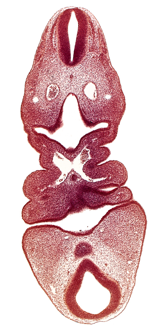 aortic arch 2, aortic sac, caudal edge of thyroid diverticulum, dermatomyotome 5 (C-1), dorsal aorta, internal carotid artery, lateral tongue eminence, mamillary recess, median tongue eminence, mesencephalon, oral fissure, pharyngeal arch 3, pharyngeal pouch 4, pharynx primordium