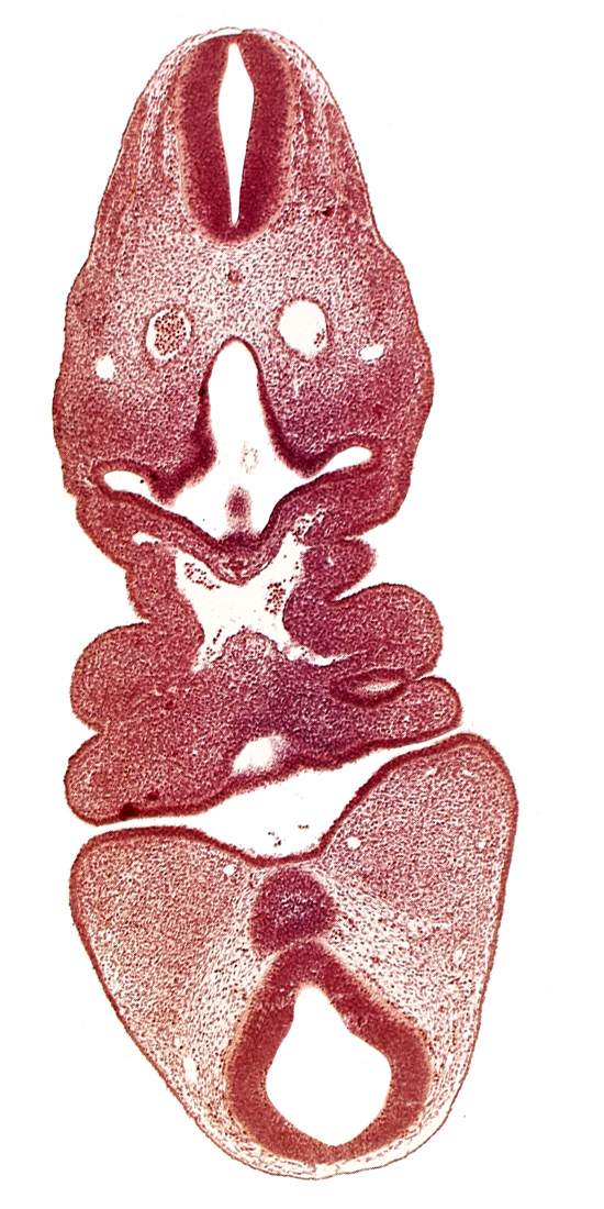 aortic arch 4, aortic sac, cervical sinus, dermatomyotome 5 (C-1), dorsal aorta, internal carotid artery, mamillary recess, mandibular prominence of pharyngeal arch 1, maxillary prominence of pharyngeal arch 1, mesencephalon, pharyngeal arch 2, pharyngeal pouch 1