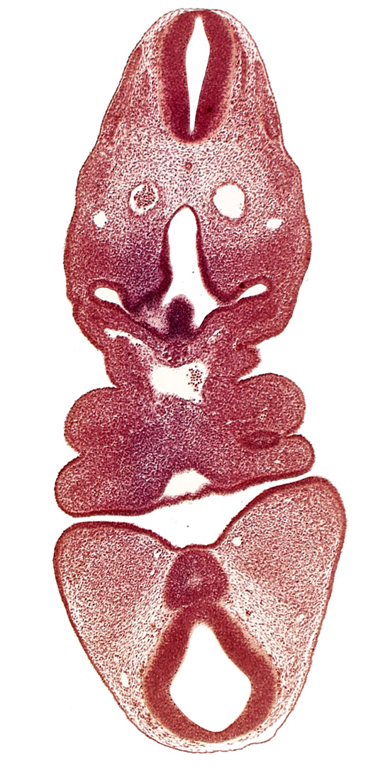 aortic sac, cervical sinus, dermatomyotome 5 (C-1), dorsal aorta, internal carotid artery, junction of aortic arch 2 and aortic sac, junction of aortic arch 4 and aortic sac, mamillary recess, mandibular prominence of pharyngeal arch 1, maxillary prominence of pharyngeal arch 1, mesencephalon, pharyngeal arch 2, pharyngeal pouch 1, precardinal vein, ultimopharyngeal pouch