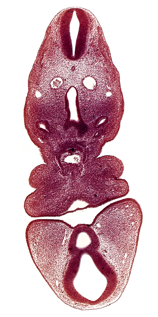 anterior dural venous plexus, dermatomyotome 5 (C-1), dorsal aorta, internal carotid artery, mamillary recess, mandibular prominence of pharyngeal arch 1, maxillary prominence of pharyngeal arch 1, oral fissure, pharyngeal arch 2, pharyngeal groove 1, precardinal vein, prosencoel (third ventricle), truncus arteriosus, ultimopharyngeal pouch