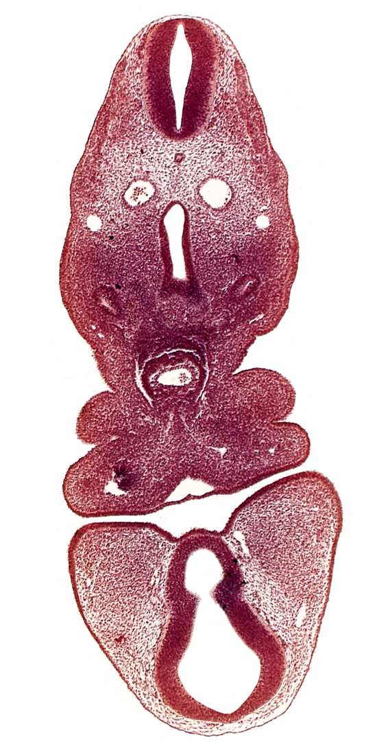 cephalic extent of pericardial cavity, dermatomyotome 5 (C-1), dorsal aorta, dorsal thalamus (diencephalon), internal carotid artery, mandibulary vein, maxillary prominence of pharyngeal arch 1, pharyngeal arch 2, pharyngeal groove 1, precardinal vein, prosencoel (third ventricle), truncus arteriosus, ventral pharyngeal vein, ventral thalamus (diencephalon)