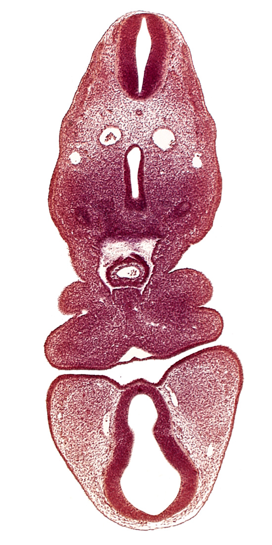 caudal edge of ultimopharyngeal pouch, caudal part of foregut, dermatomyotome 5 (C-1), dorsal aorta, dorsal thalamus (diencephalon), internal carotid artery, maxillary prominence of pharyngeal arch 1, oral fissure, pericardial cavity, pharyngeal arch 2, pharyngeal groove 1, precardinal vein, prosencoel (third ventricle), truncus arteriosus, ventral thalamus (diencephalon)