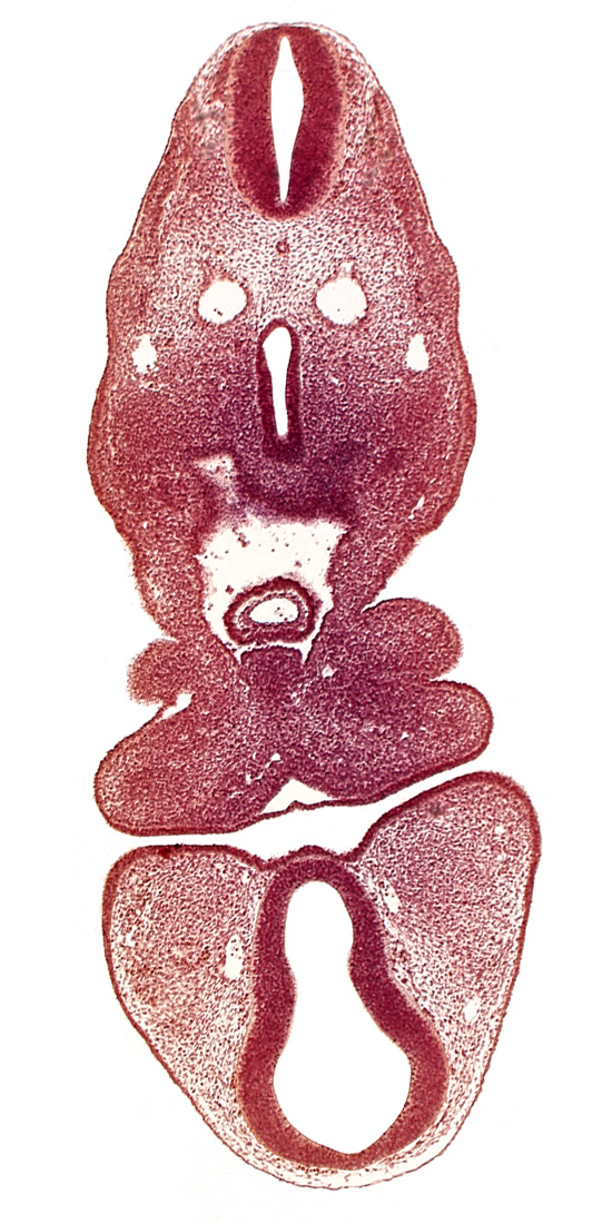 anterior dural vein, caudal edge of ultimopharyngeal pouch, dermatomyotome 5 (C-1), dorsal thalamus (diencephalon), internal carotid artery, mandibular prominence of pharyngeal arch 1, maxillary prominence of pharyngeal arch 1, oral fissure, origin of intersegmental artery from dorsal aorta, pericardial cavity, precardinal vein, prosencoel (third ventricle), tracheo-esophageal tube, truncus arteriosus, ventral thalamus (diencephalon)