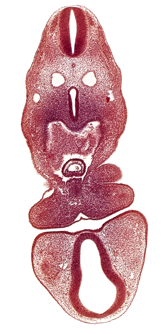 C-1 spinal ganglion primordium, anterior dural vein, cephalic part of left atrium, dermatomyotome 5 (C-1), dorsal thalamus (diencephalon), mandibular prominence of pharyngeal arch 1, oral fissure, pericardial cavity, precardinal vein, prosencoel (third ventricle), truncus arteriosus, ventral thalamus (diencephalon)