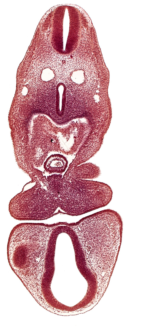 C-1 spinal ganglion primordium, anterior dural vein, caudal edge of optic vesicle, dermatomyotome 5 (C-1), dorsal thalamus (diencephalon), left atrium, mandibular prominence of pharyngeal arch 1, oral fissure, pericardial cavity, prosencoel (third ventricle), separation artifact, truncus arteriosus